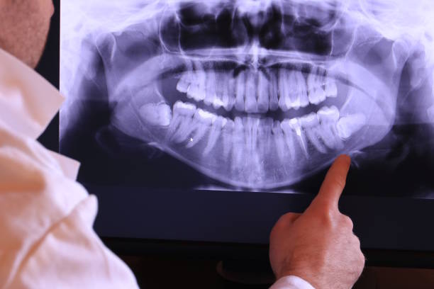 Best Broken or Chipped Tooth Repair in Pageland, SC